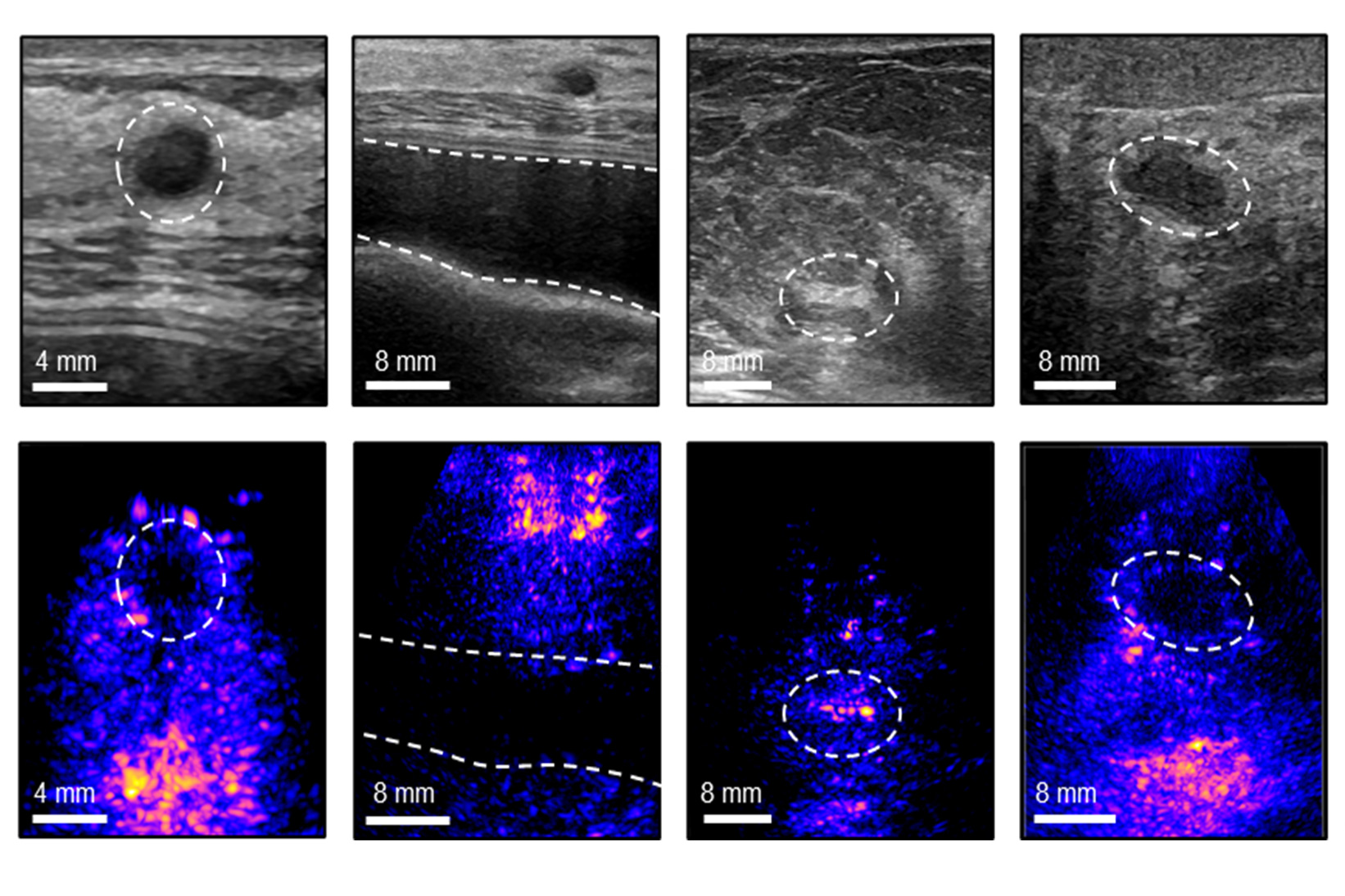 Sistema Portátil de Ultrassom Pode Tornar Imagens de Mama Mais Acessíveis e Confiáveis