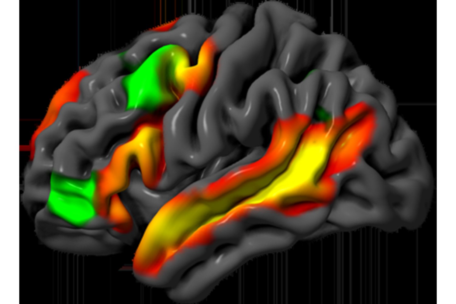 Separating Logic and Language: Insights from Neurocognitive Research