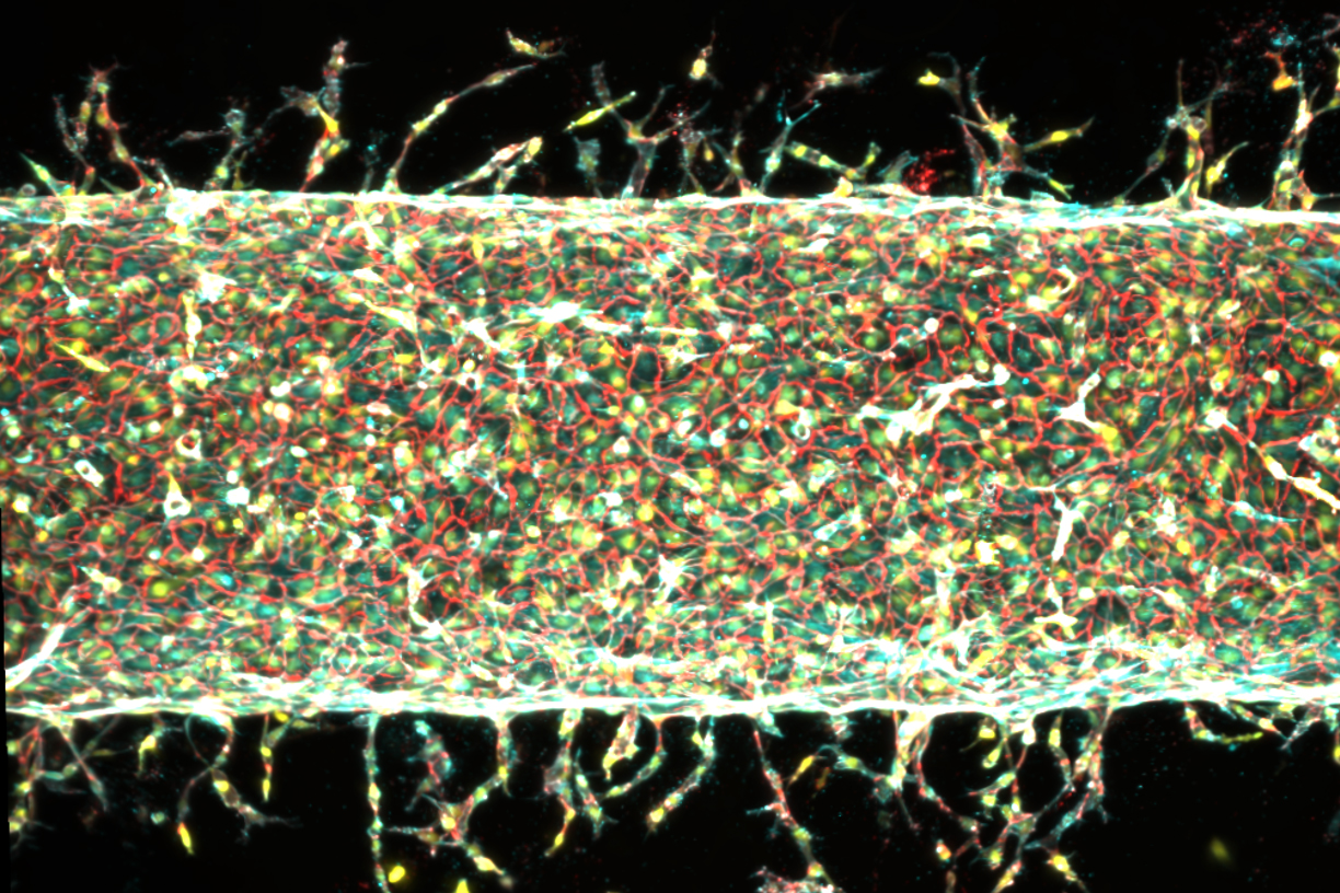 MIT Engineers Perfect Method for Growing Artificial Blood Vessels