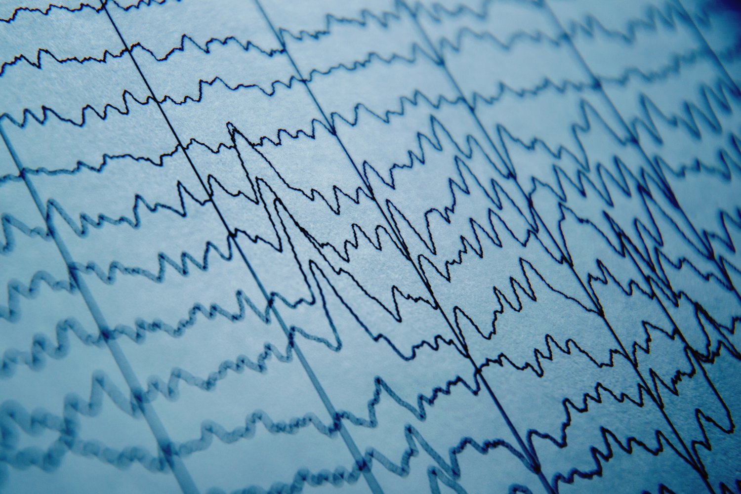 Campos Elétricos Orientam a Atividade Neural: Uma Nova Era na Neurociência