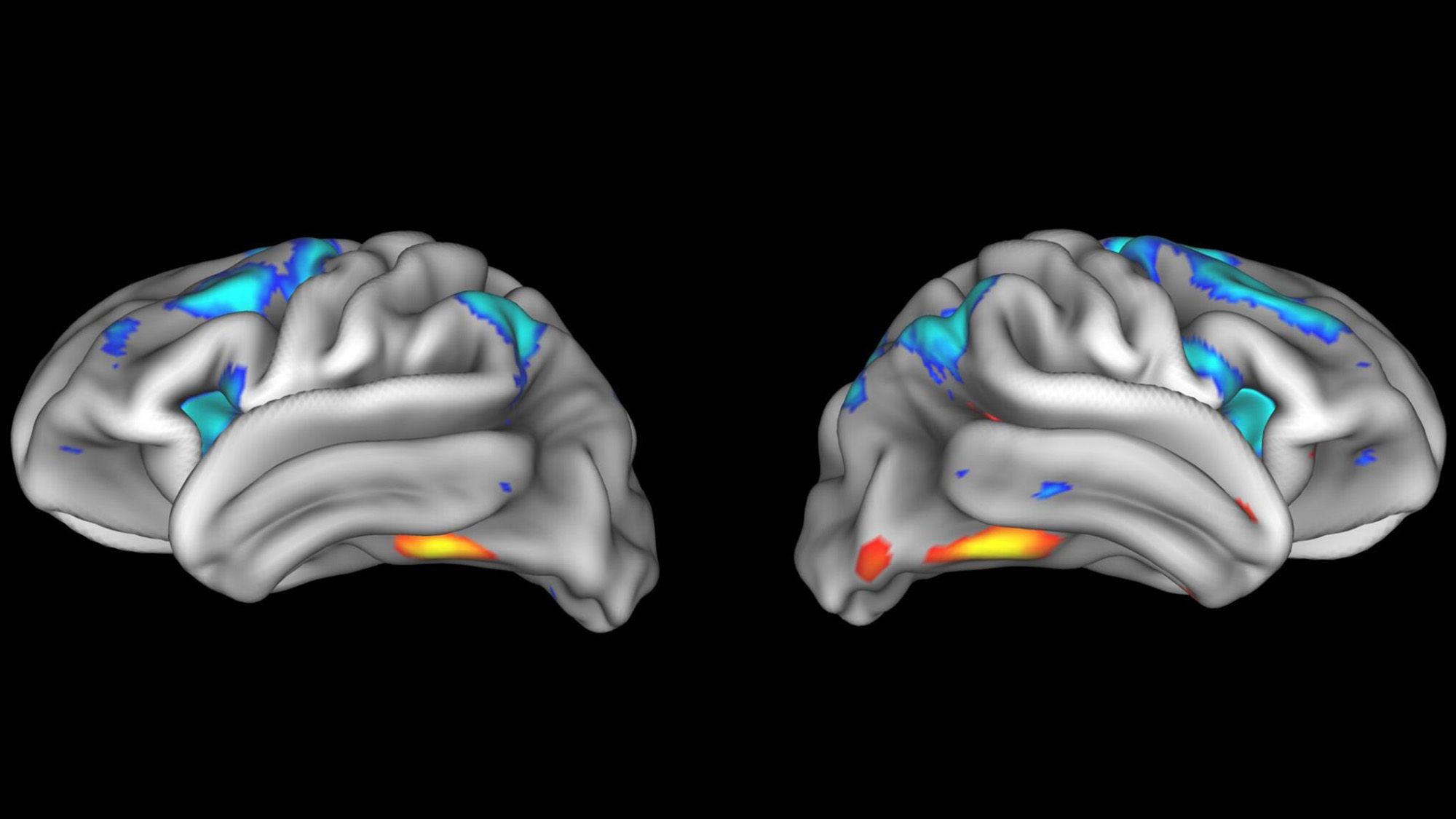 Neuroscience Replication Crisis: Unveiling the Fragile Foundations of Brain Research