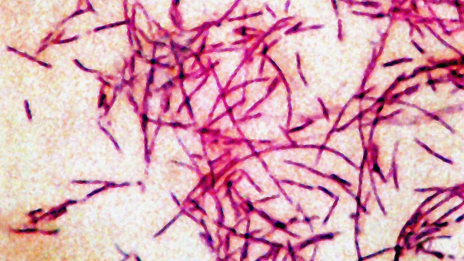 A Guerra Invisível: A Epidemia de Doença dos Legionários em Nova Iorque