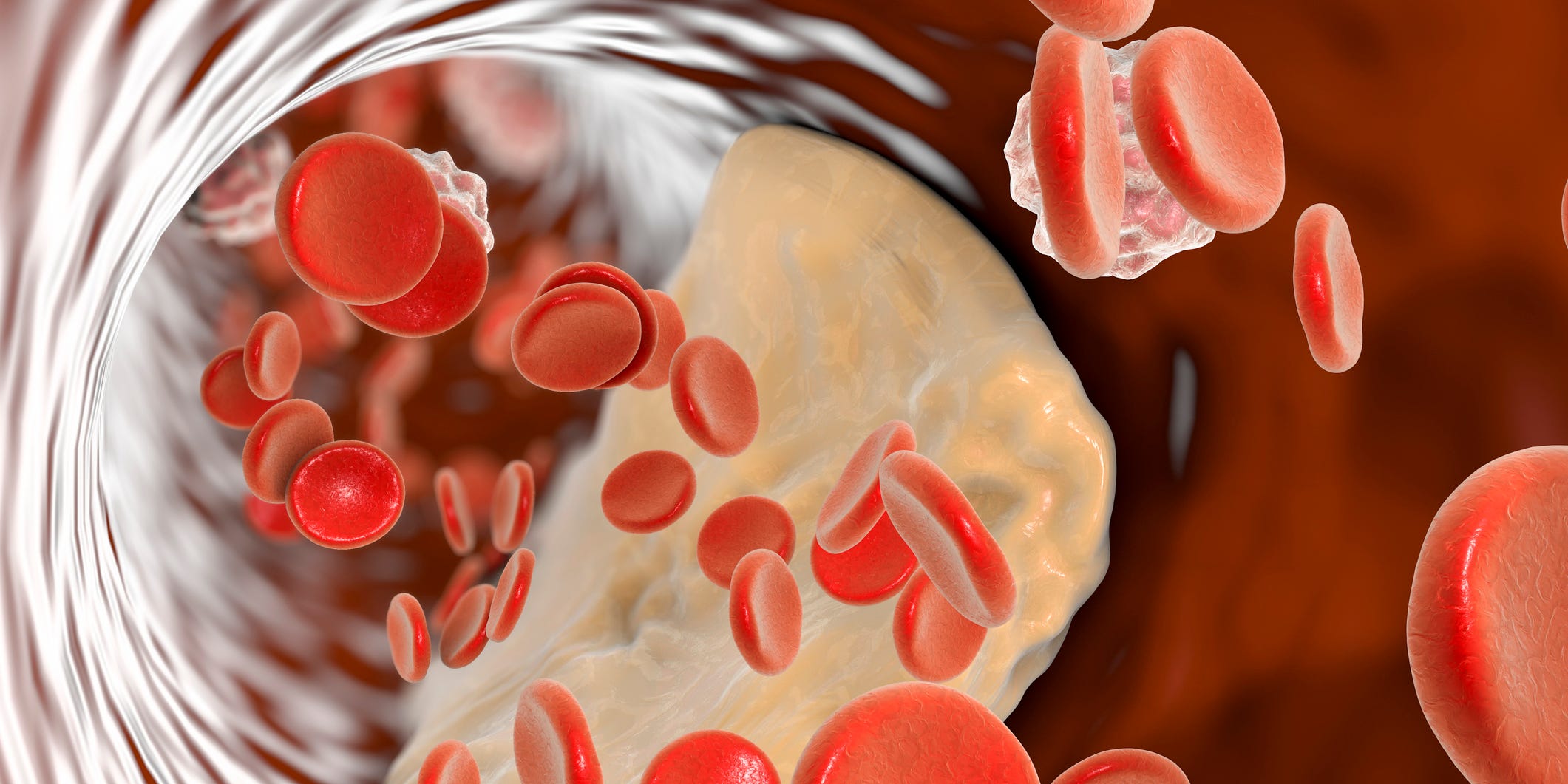 Cardiologistas Revelam: Teste Rápido Pode Transformar a Avaliação do Colesterol